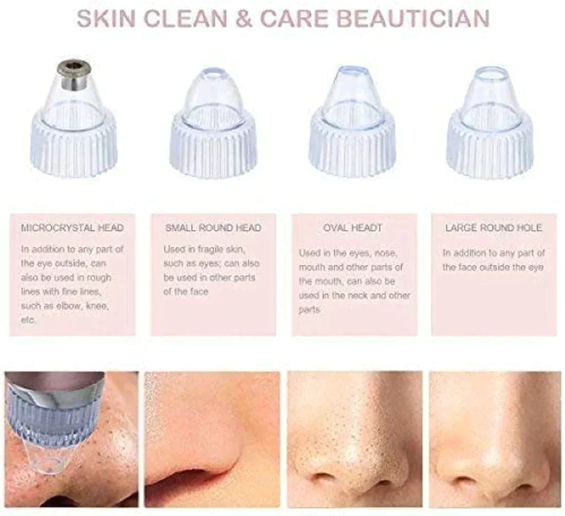 DERMASUCTION™ | PIMPLE & BLACKHEAD REMOVER